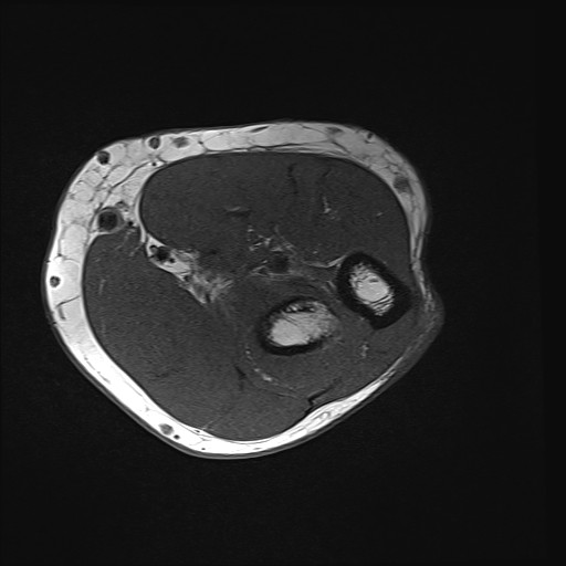 Click on the Serie image to view the images of Wieszt, Gnter